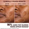 DARK SPOT CORRECTING INVISIBLE UV DUO SKINCARE SET